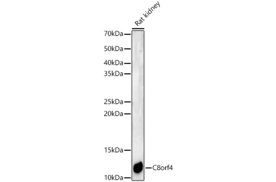 Western Blot - Anti-TCIM Antibody (A15123) - Antibodies.com