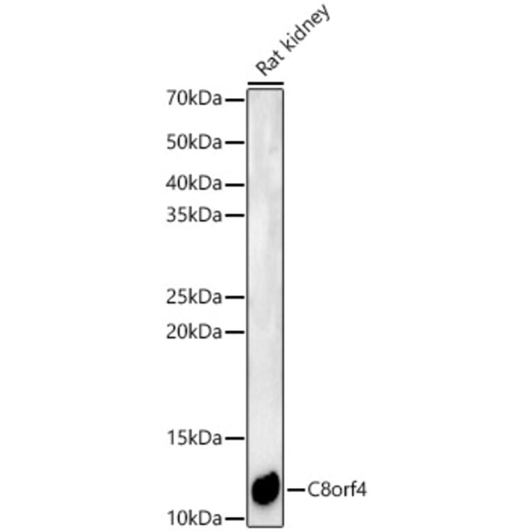Western Blot - Anti-TCIM Antibody (A15123) - Antibodies.com