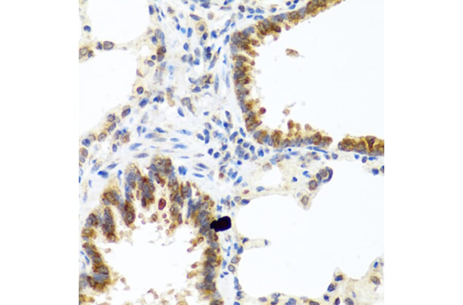 Immunohistochemistry - Anti-TCIM Antibody (A15123) - Antibodies.com