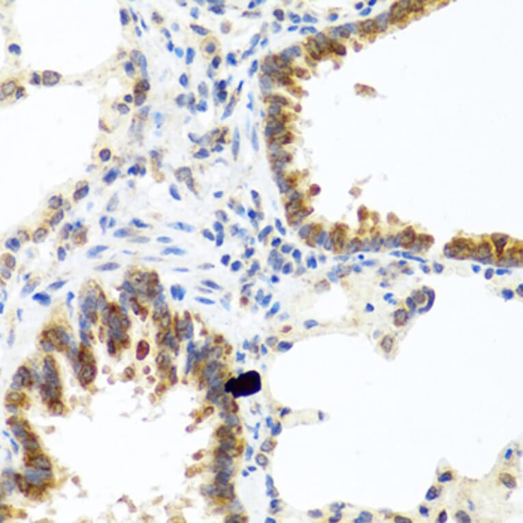 Immunohistochemistry - Anti-TCIM Antibody (A15123) - Antibodies.com