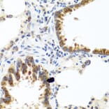 Immunohistochemistry - Anti-TCIM Antibody (A15123) - Antibodies.com