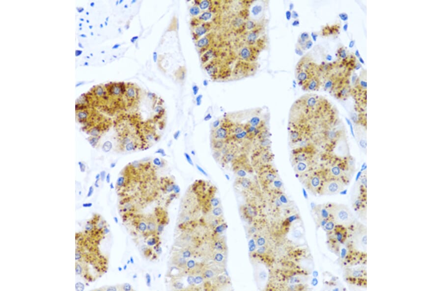Immunohistochemistry - Anti-TCIM Antibody (A15123) - Antibodies.com