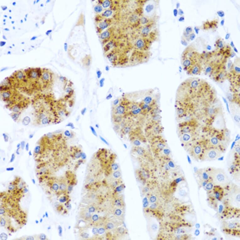 Immunohistochemistry - Anti-TCIM Antibody (A15123) - Antibodies.com