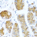 Immunohistochemistry - Anti-TCIM Antibody (A15123) - Antibodies.com