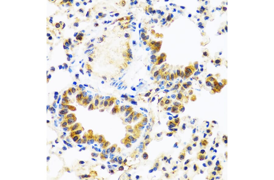 Immunohistochemistry - Anti-TCIM Antibody (A15123) - Antibodies.com