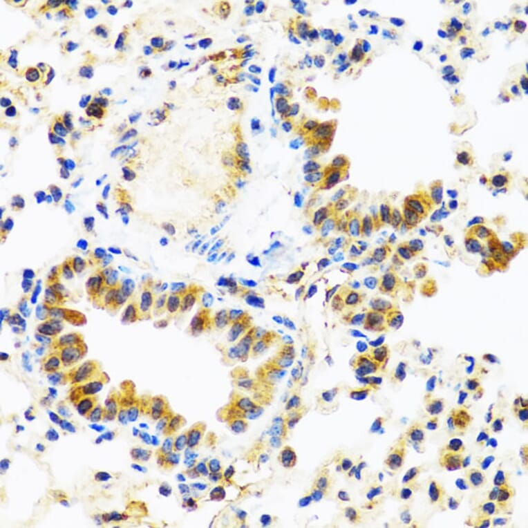 Immunohistochemistry - Anti-TCIM Antibody (A15123) - Antibodies.com