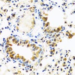 Immunohistochemistry - Anti-TCIM Antibody (A15123) - Antibodies.com