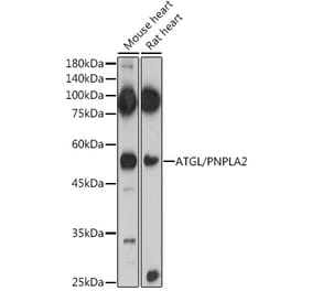 Western Blot - Anti-Adipose Triglyceride Lipase Antibody (A15124) - Antibodies.com