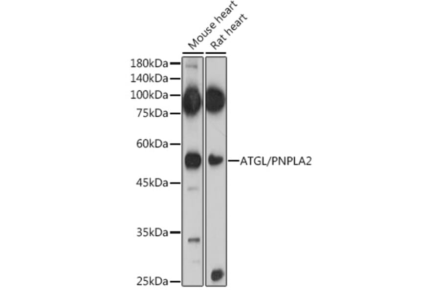Western Blot - Anti-Adipose Triglyceride Lipase Antibody (A15124) - Antibodies.com