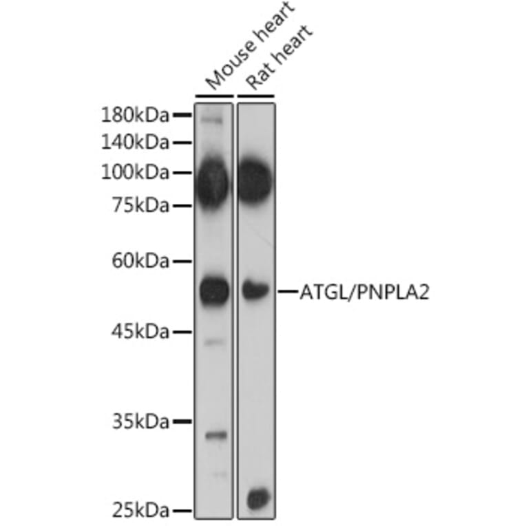 Western Blot - Anti-Adipose Triglyceride Lipase Antibody (A15124) - Antibodies.com