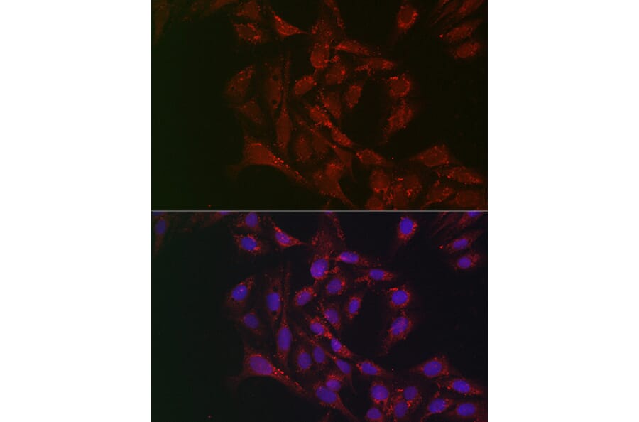 Immunofluorescence - Anti-Adipose Triglyceride Lipase Antibody (A15124) - Antibodies.com