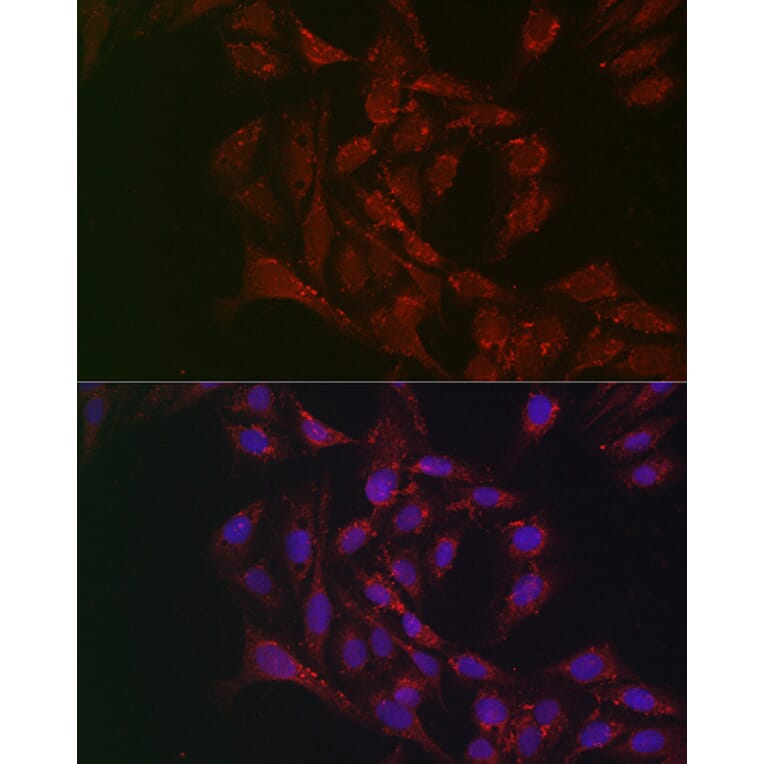Immunofluorescence - Anti-Adipose Triglyceride Lipase Antibody (A15124) - Antibodies.com