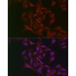 Immunofluorescence - Anti-Adipose Triglyceride Lipase Antibody (A15124) - Antibodies.com