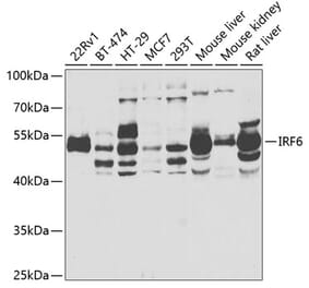 Western Blot - Anti-IRF6 Antibody (A6246) - Antibodies.com
