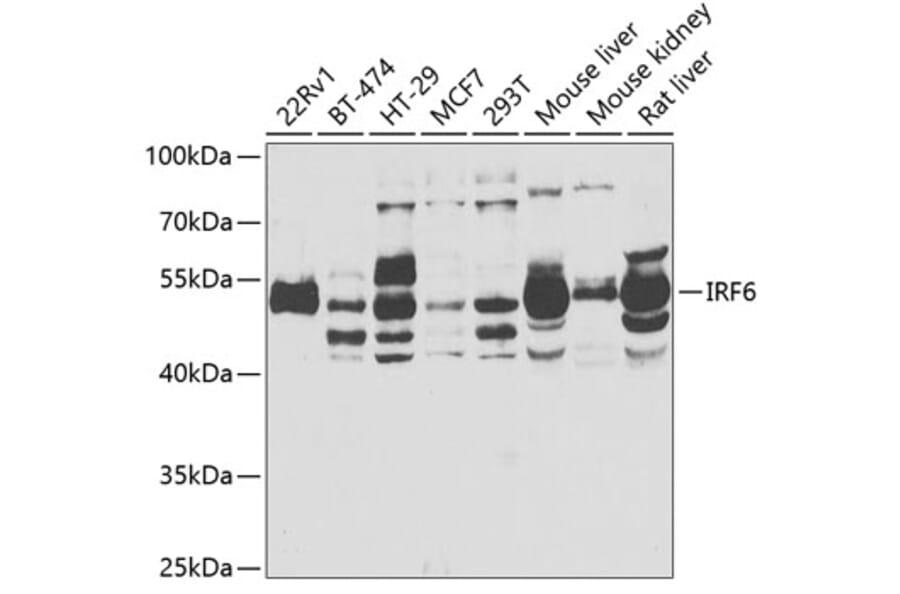 Western Blot - Anti-IRF6 Antibody (A6246) - Antibodies.com