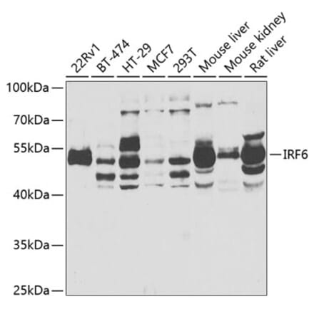 Western Blot - Anti-IRF6 Antibody (A6246) - Antibodies.com