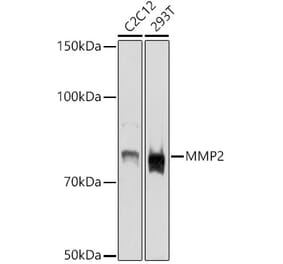 Western Blot - Anti-MMP2 Antibody (A15126) - Antibodies.com