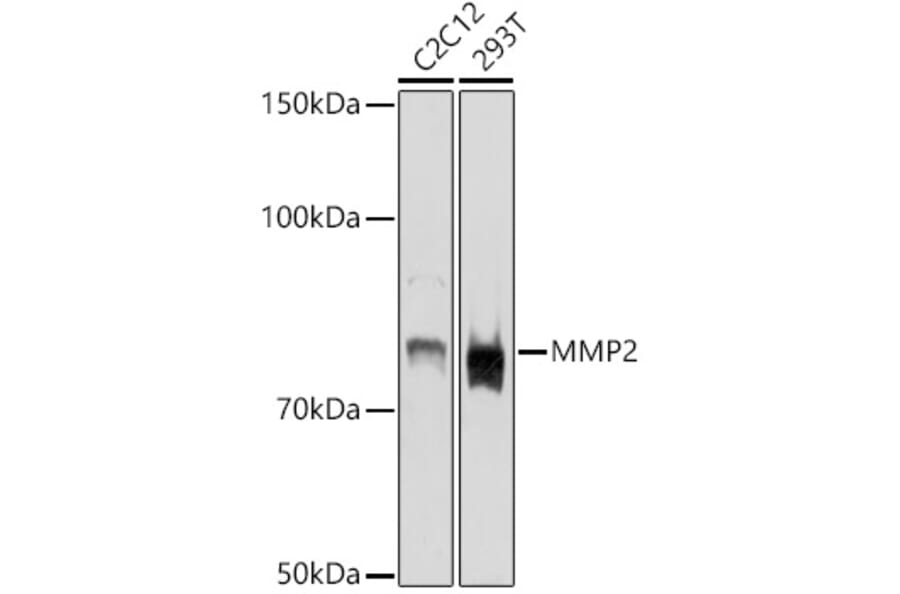 Western Blot - Anti-MMP2 Antibody (A15126) - Antibodies.com