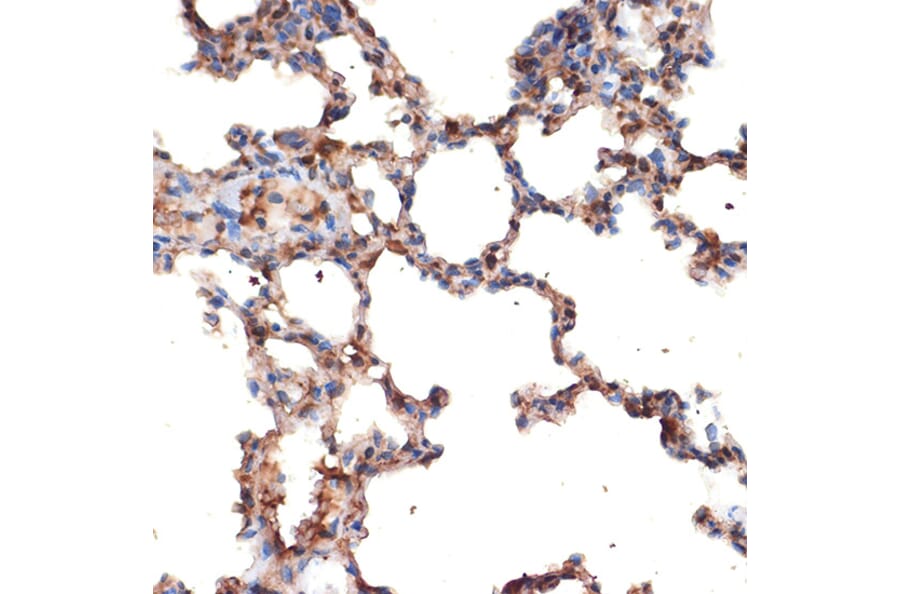 Immunohistochemistry - Anti-MMP2 Antibody (A15126) - Antibodies.com