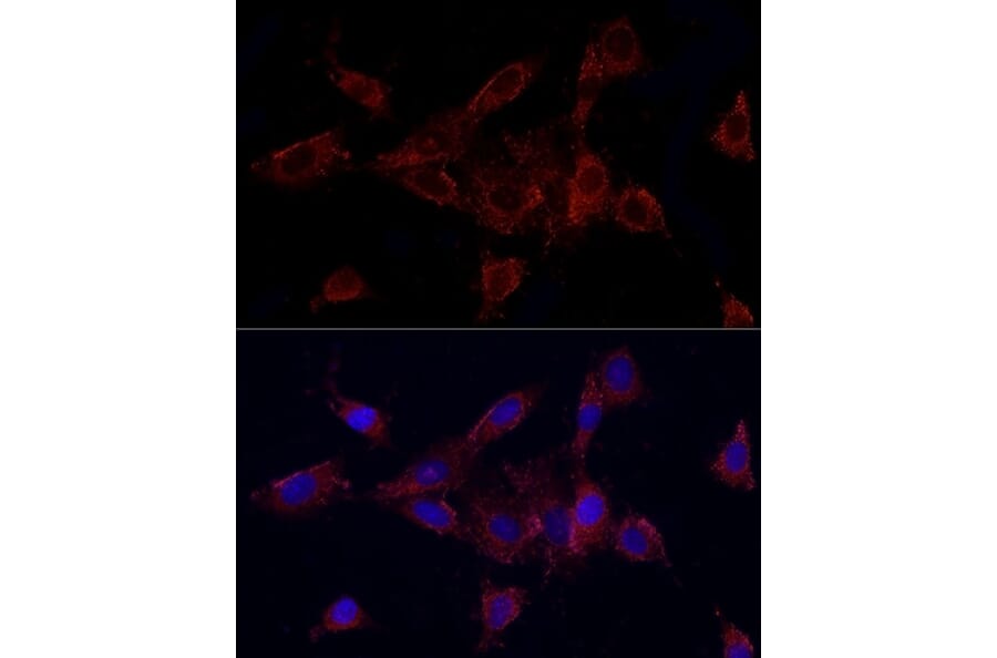 Immunofluorescence - Anti-MMP2 Antibody (A15126) - Antibodies.com