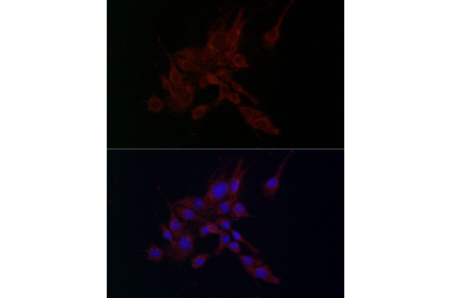 Immunofluorescence - Anti-MMP2 Antibody (A15126) - Antibodies.com