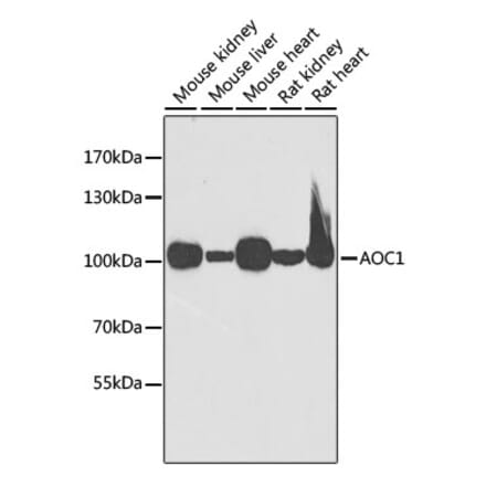 Western Blot - Anti-ABP1 Antibody (A15128) - Antibodies.com
