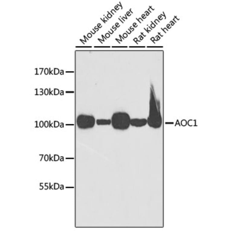 Western Blot - Anti-ABP1 Antibody (A15128) - Antibodies.com