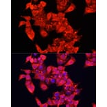 Immunofluorescence - Anti-ABP1 Antibody (A15128) - Antibodies.com