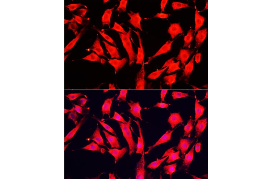 Immunofluorescence - Anti-ABP1 Antibody (A15128) - Antibodies.com