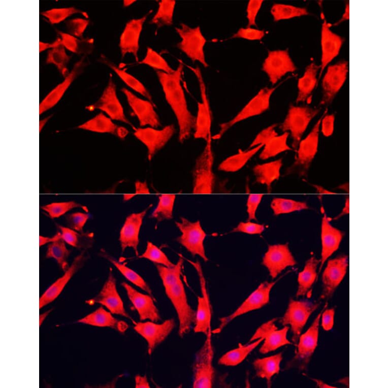 Immunofluorescence - Anti-ABP1 Antibody (A15128) - Antibodies.com