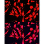 Immunofluorescence - Anti-ABP1 Antibody (A15128) - Antibodies.com