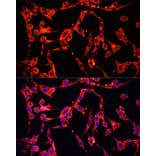 Immunofluorescence - Anti-ABP1 Antibody (A15128) - Antibodies.com