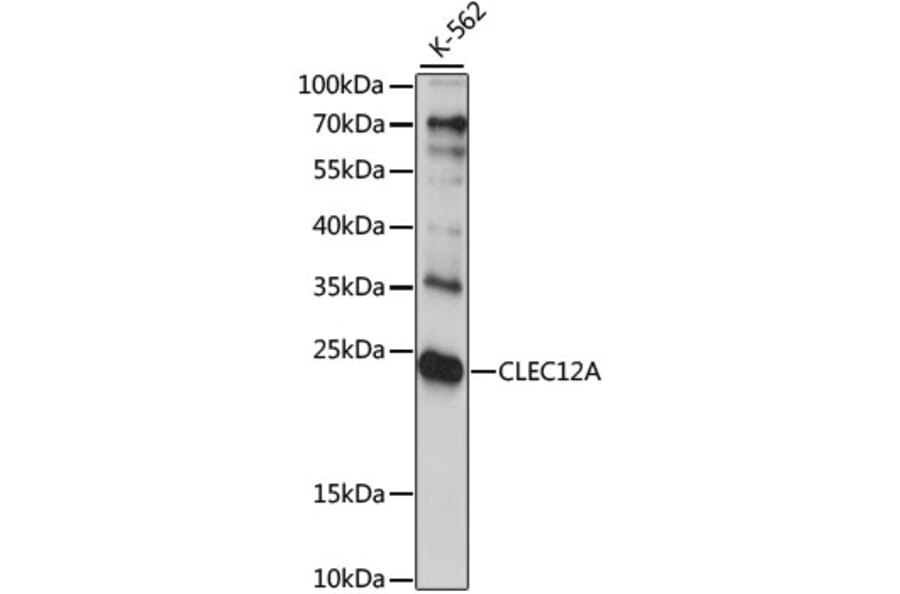 Western Blot - Anti-CLEC12A Antibody (A15129) - Antibodies.com