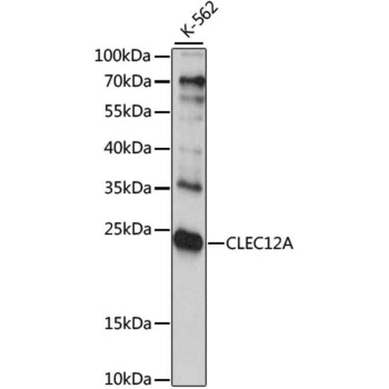 Western Blot - Anti-CLEC12A Antibody (A15129) - Antibodies.com