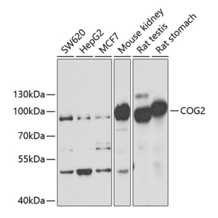 Western Blot - Anti-LDLC Antibody (A15130) - Antibodies.com