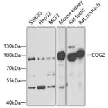 Western Blot - Anti-LDLC Antibody (A15130) - Antibodies.com