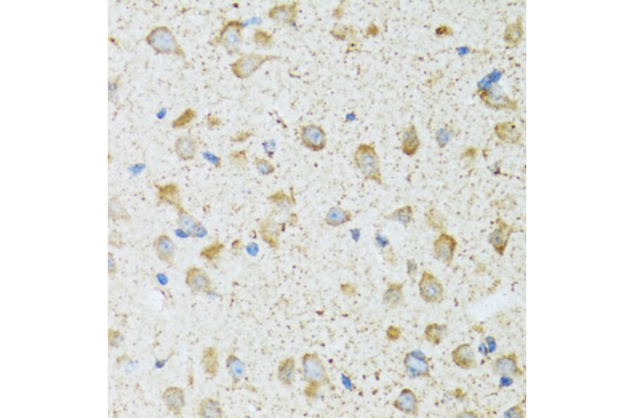 Immunohistochemistry - Anti-LDLC Antibody (A15130) - Antibodies.com