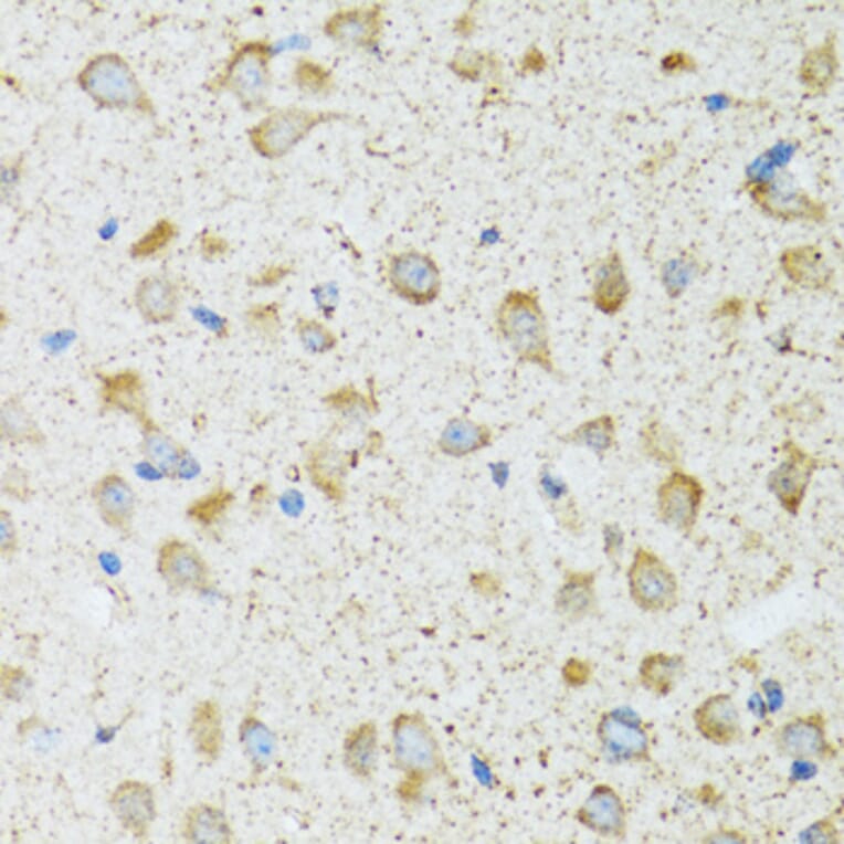 Immunohistochemistry - Anti-LDLC Antibody (A15130) - Antibodies.com