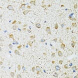 Immunohistochemistry - Anti-LDLC Antibody (A15130) - Antibodies.com