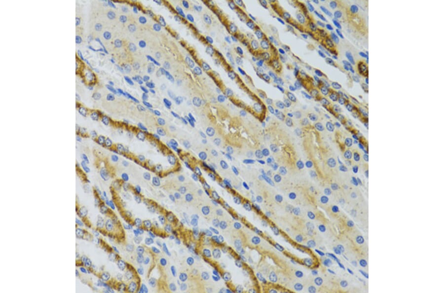 Immunohistochemistry - Anti-LDLC Antibody (A15130) - Antibodies.com