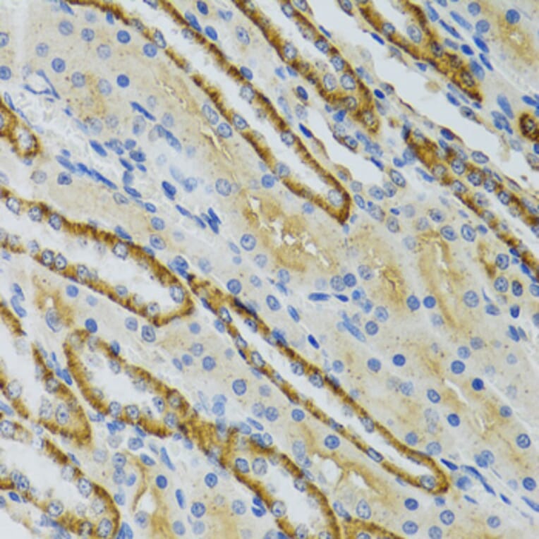 Immunohistochemistry - Anti-LDLC Antibody (A15130) - Antibodies.com