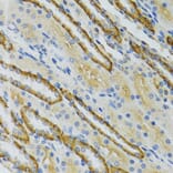 Immunohistochemistry - Anti-LDLC Antibody (A15130) - Antibodies.com