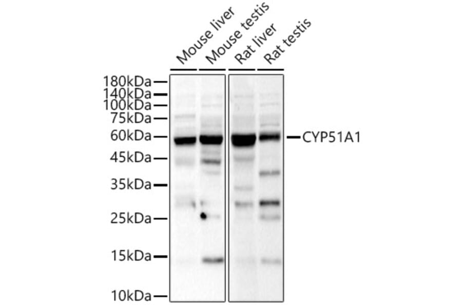 Western Blot - Anti-CYP51A1/CYP51 Antibody (A15131) - Antibodies.com