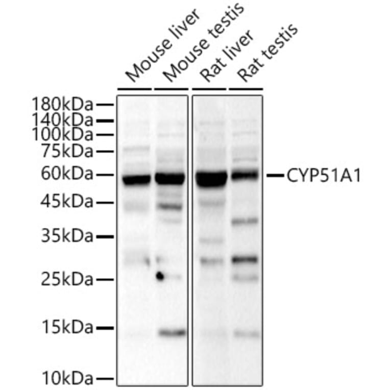 Western Blot - Anti-CYP51A1/CYP51 Antibody (A15131) - Antibodies.com