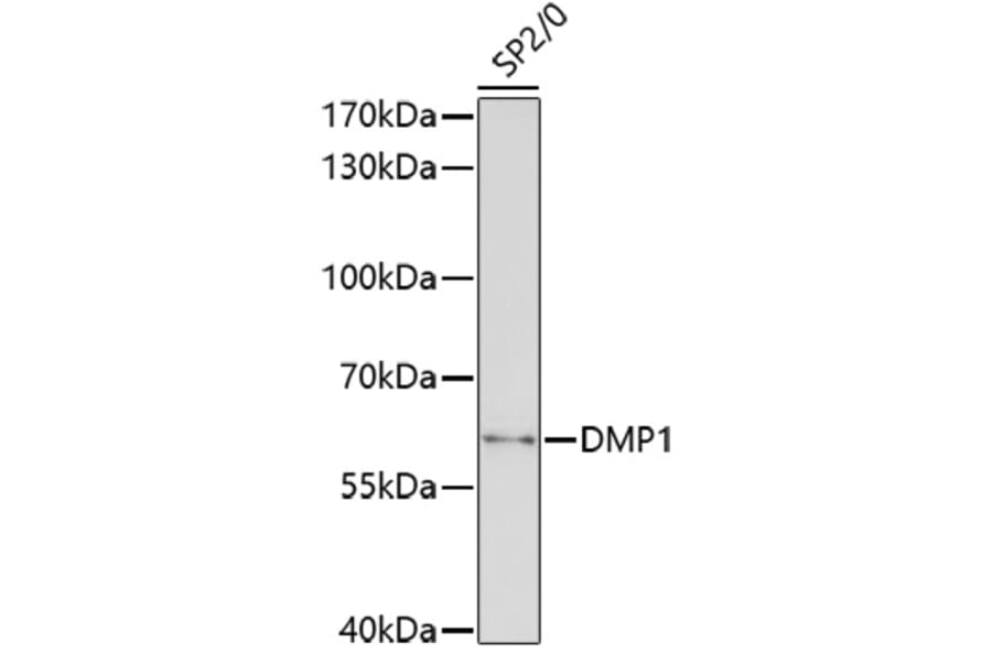 Western Blot - Anti-DMP1 Antibody (A6253) - Antibodies.com