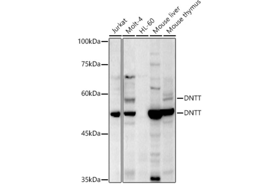 Western Blot - Anti-TdT Antibody (A15133) - Antibodies.com