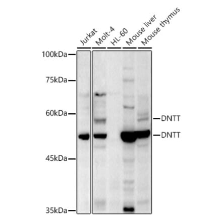 Western Blot - Anti-TdT Antibody (A15133) - Antibodies.com