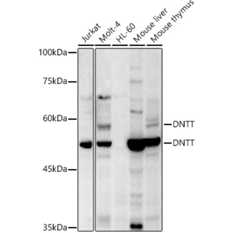 Western Blot - Anti-TdT Antibody (A15133) - Antibodies.com