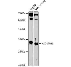 Western Blot - Anti-HSD17B13 Antibody (A15134) - Antibodies.com
