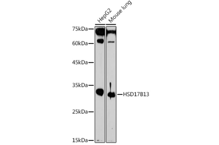 Western Blot - Anti-HSD17B13 Antibody (A15134) - Antibodies.com
